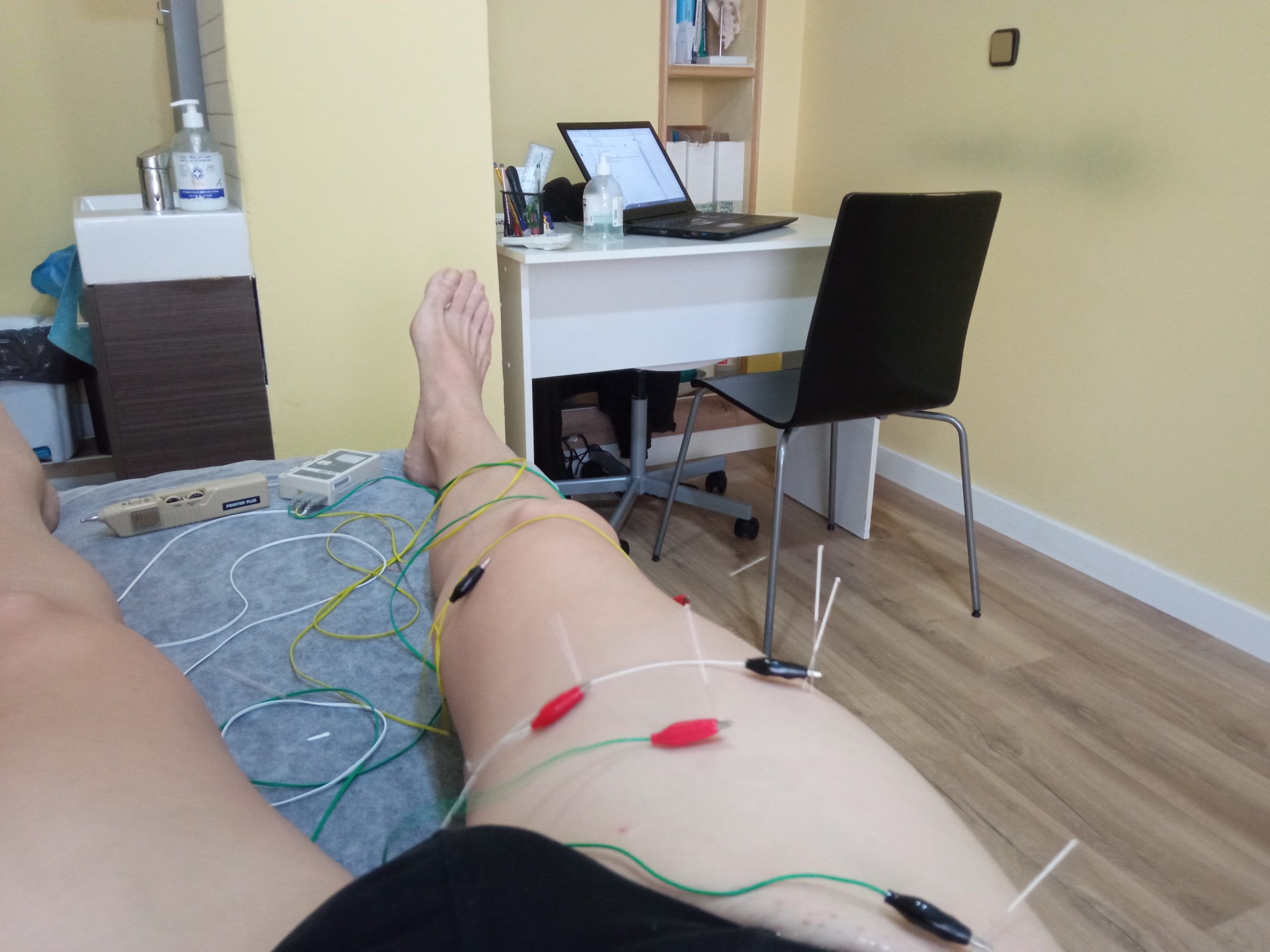 Neuromodulación