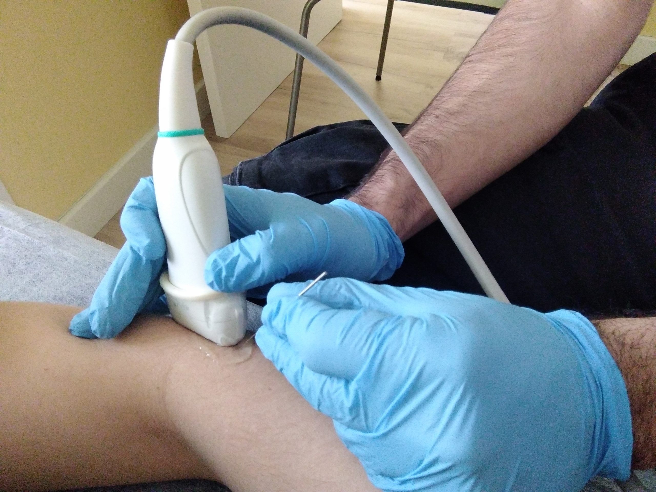 EPI® (Electrolisis)